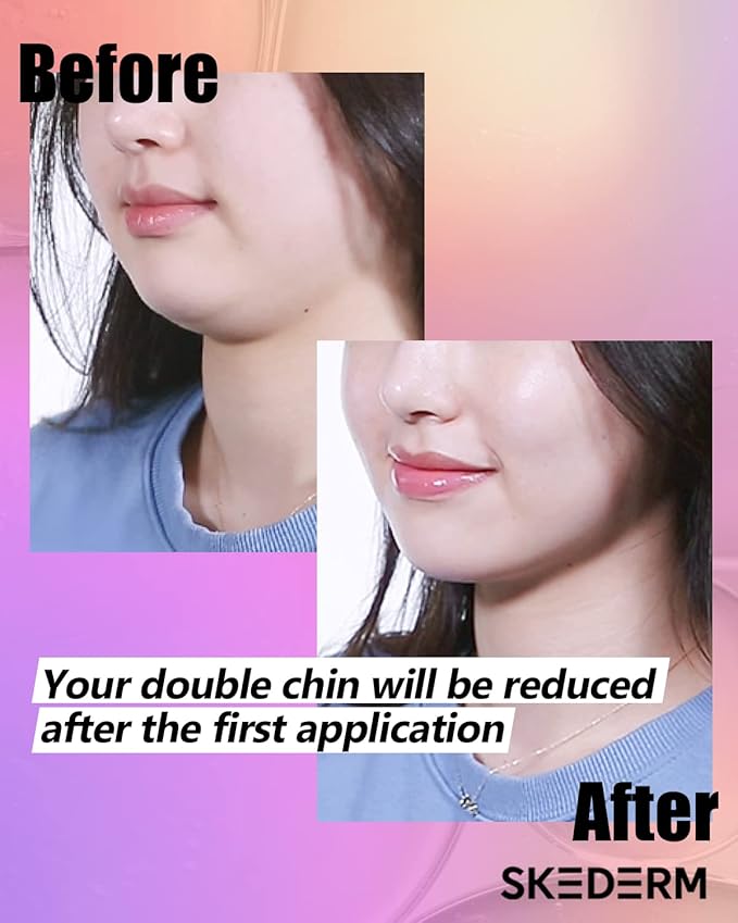 SKEDERM Lifting Patch Peptide V Up Lifting Mask